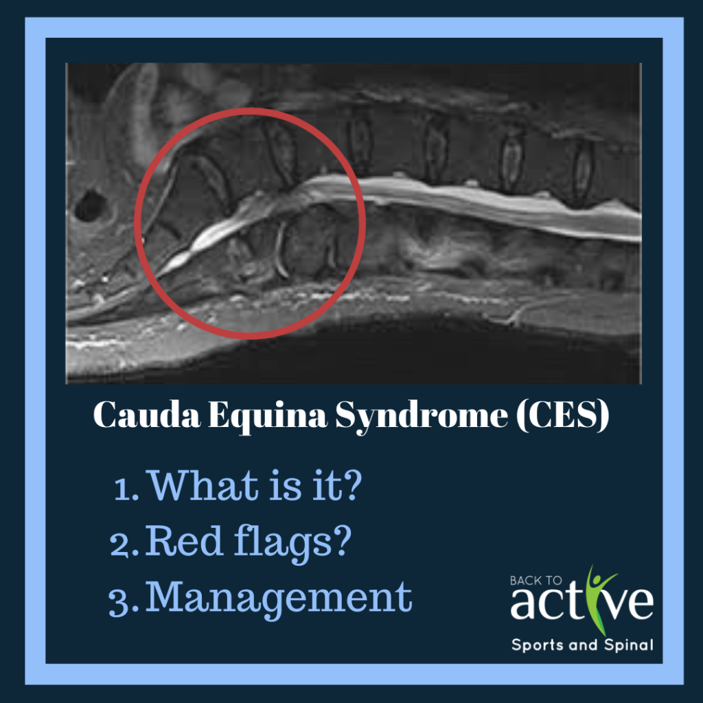 Canine Cauda Equina Syndrome