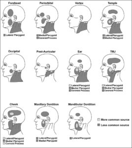 Temporomandibular disorder (TMD) - Back to Active Sports and Spinal ...